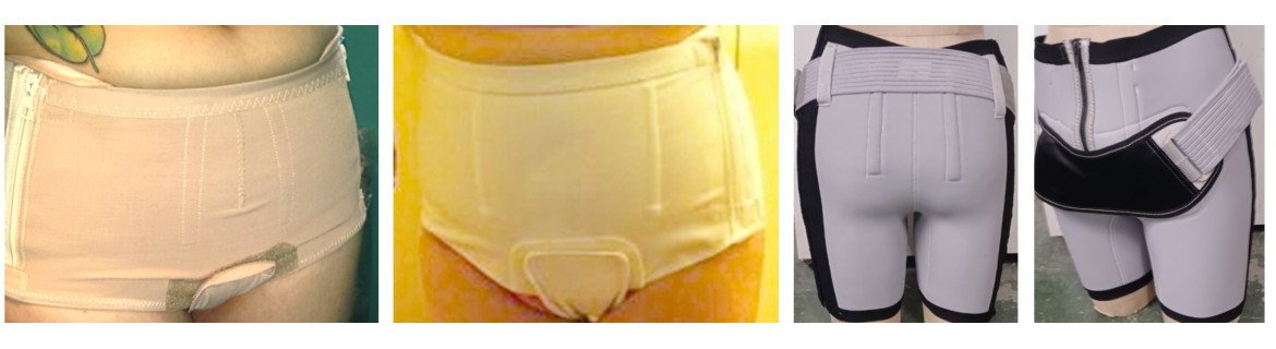 contention compression pelvienne orthopédie